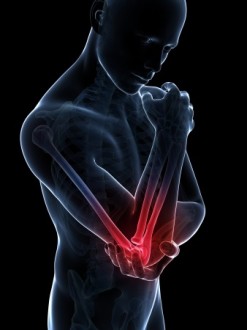 Arm Pain Driving You Crazy? Here are the Best Ways to Naturally Treat ...