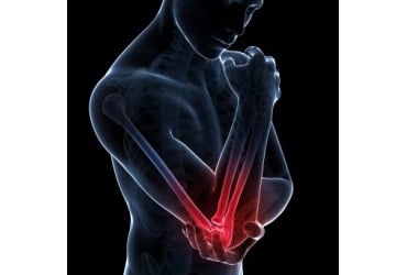 best ways to naturally treat arm pain
