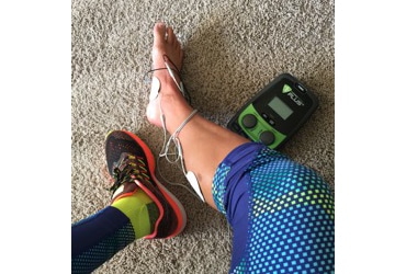 plantar fasciitis