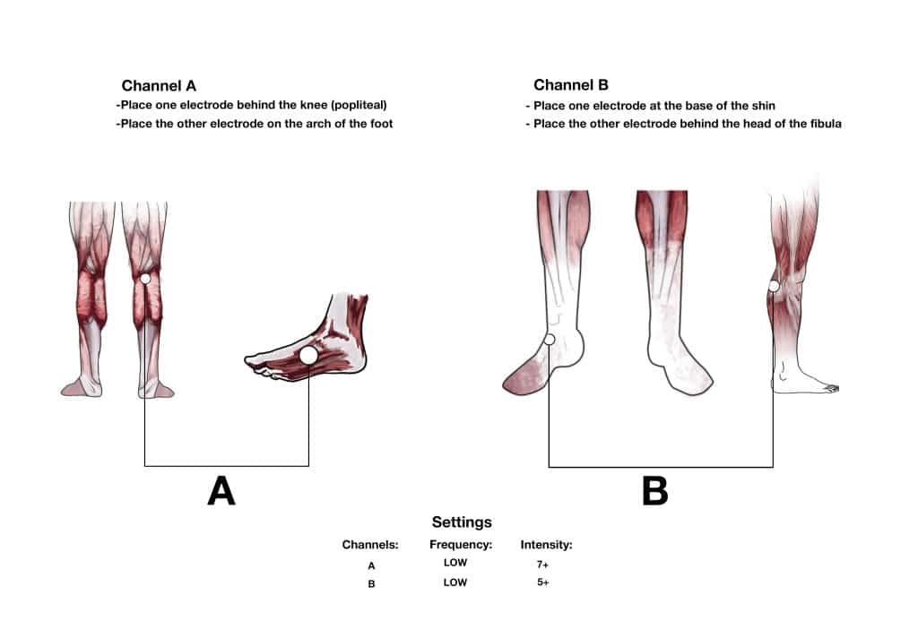 3 Ways to Prevent Plantar Fasciitis from Starting
