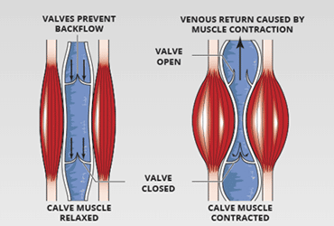 compression boots
