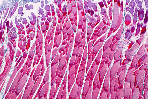 muscle tissue