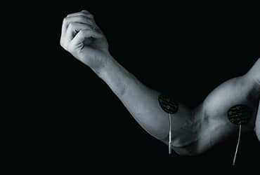 tennis elbow prevention