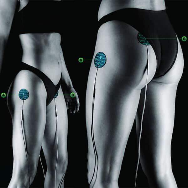 hip pain from running